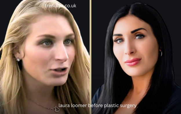 laura loomer before plastic surgery